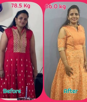 Before and After